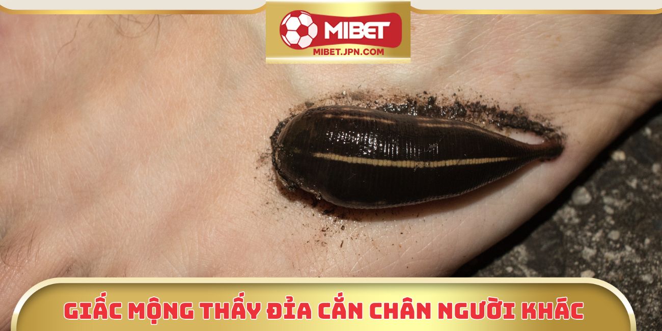 Giấc mộng thấy đỉa cắn chân người khác