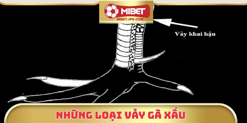 Khám phá những loại vảy gà xấu